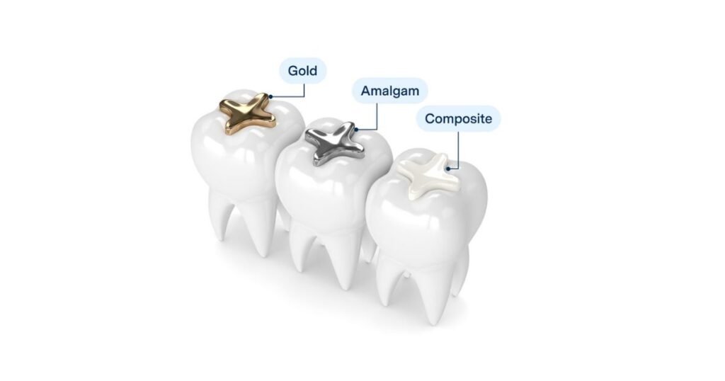 white fillings